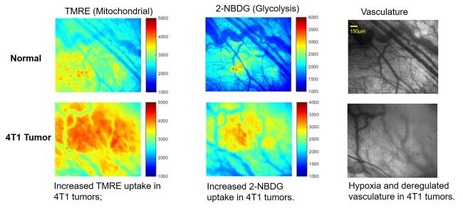 metabolic imaging